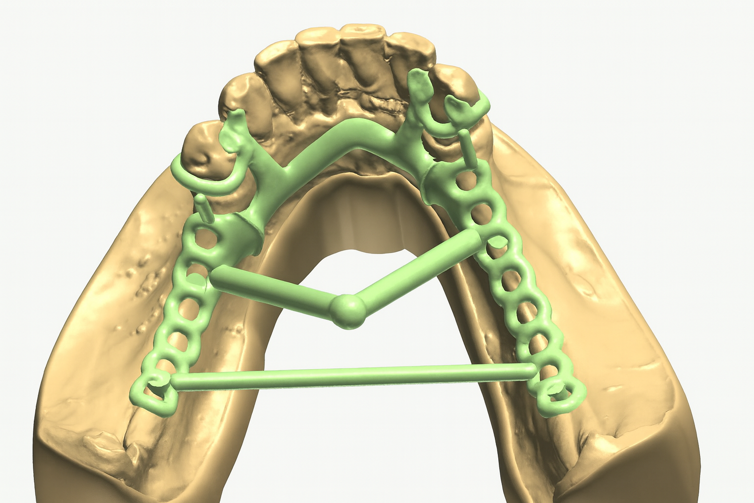 Cad-cast - New B Dental