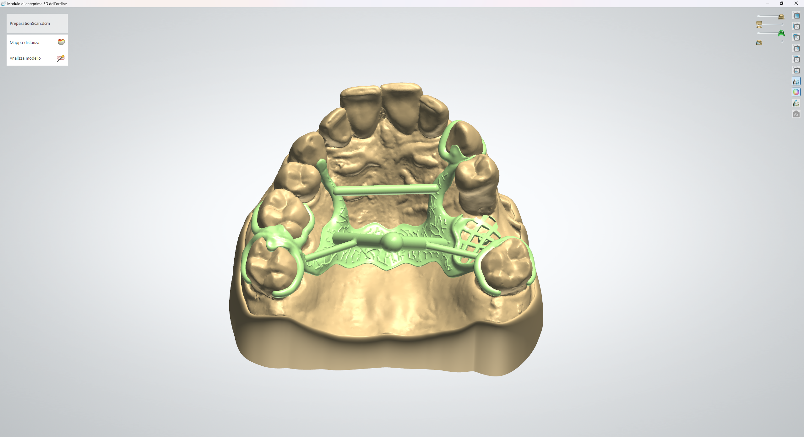 Cad-cast - New B Dental