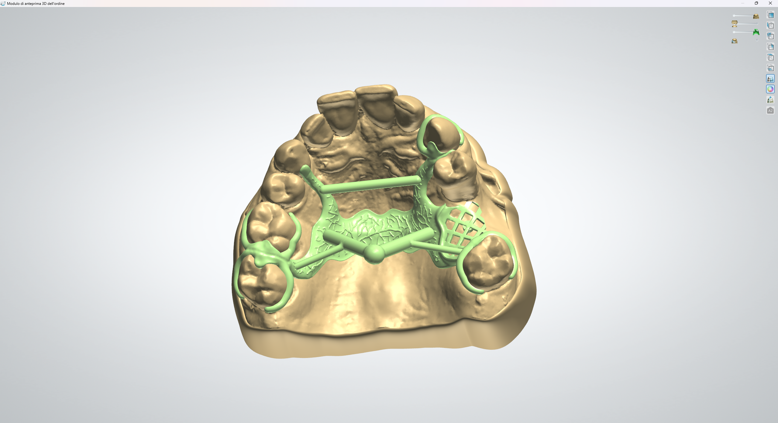 Cad-cast - New B Dental
