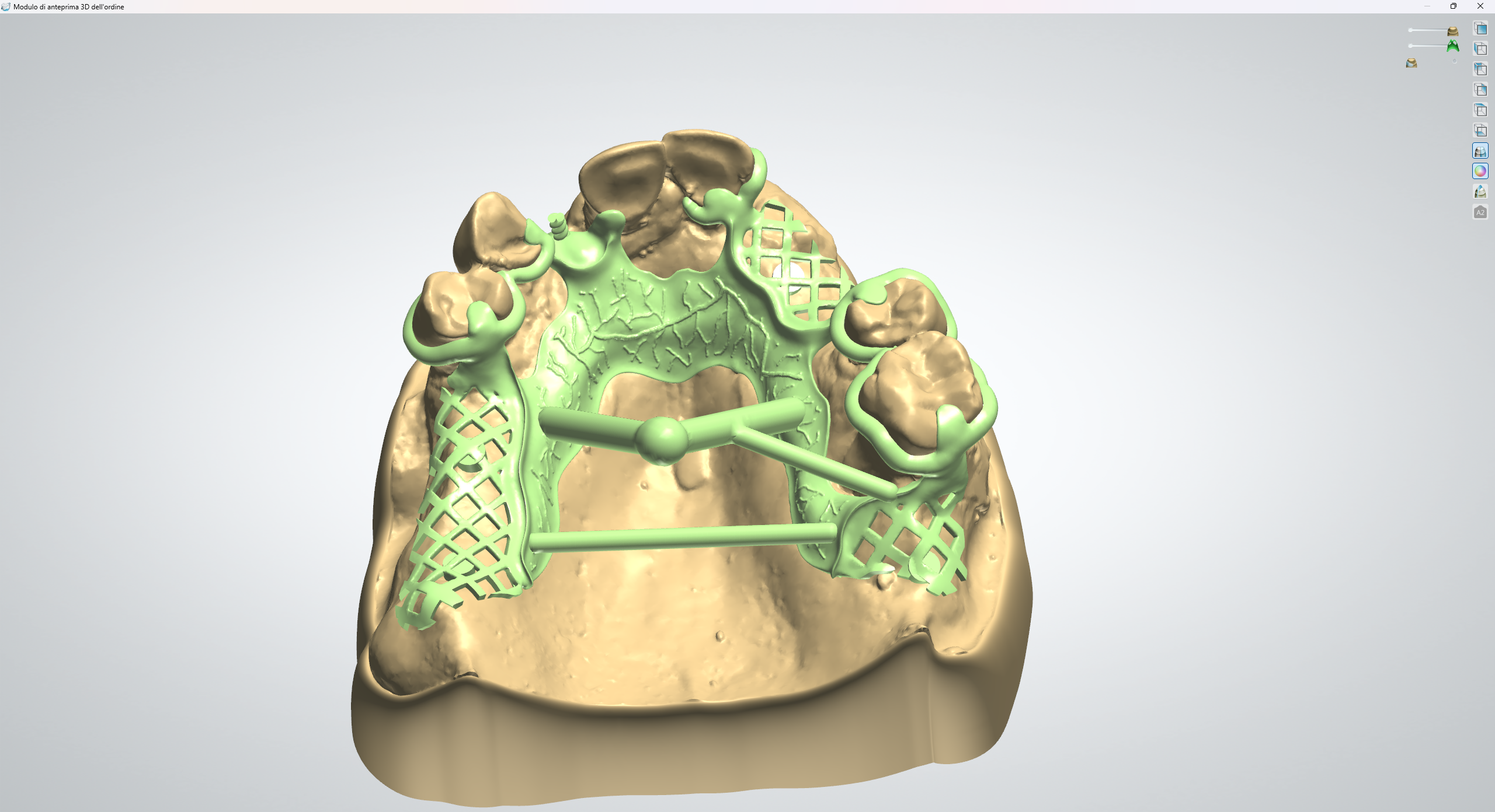 Cad-cast - New B Dental