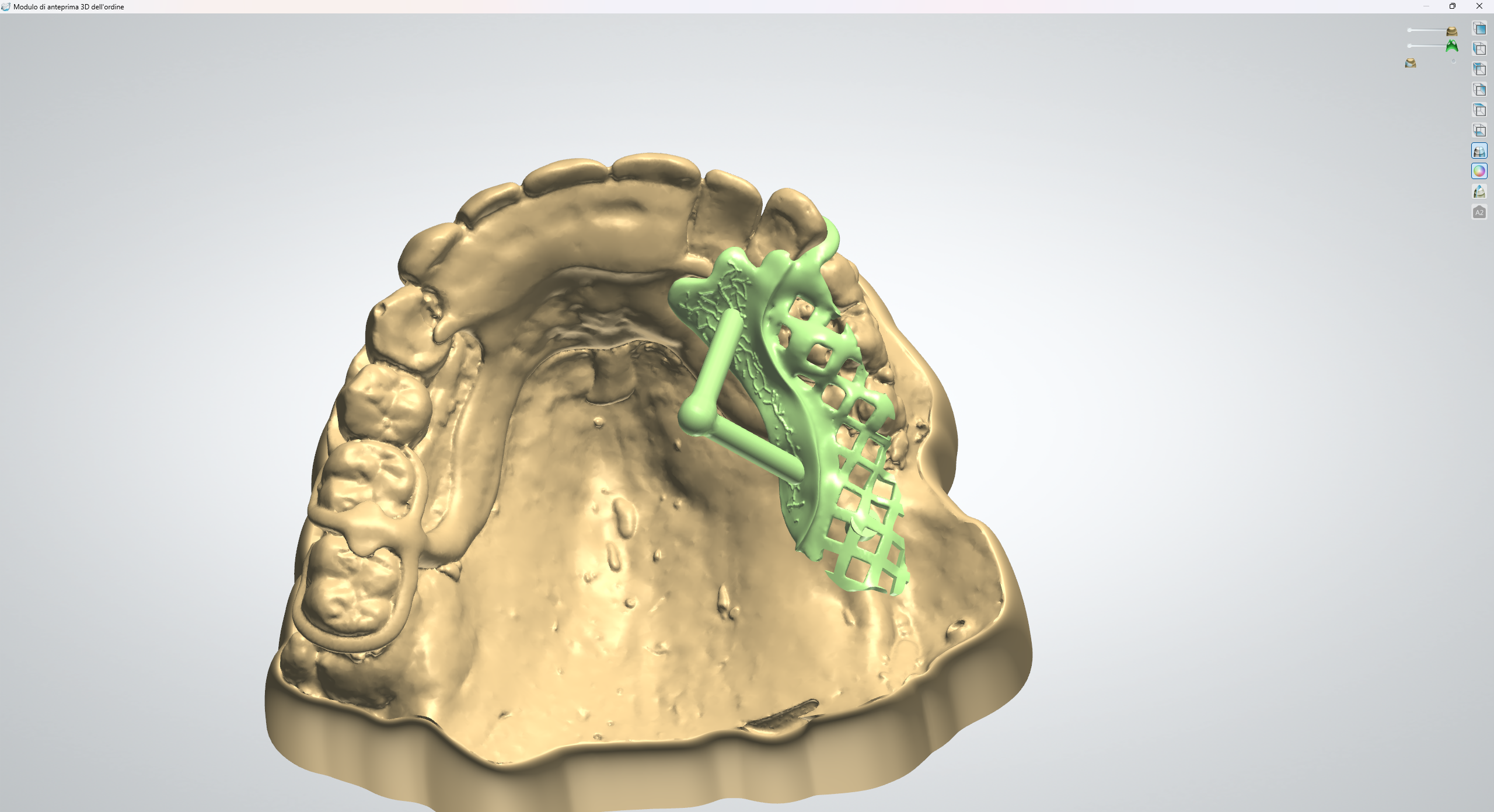 Cad-cast - New B Dental