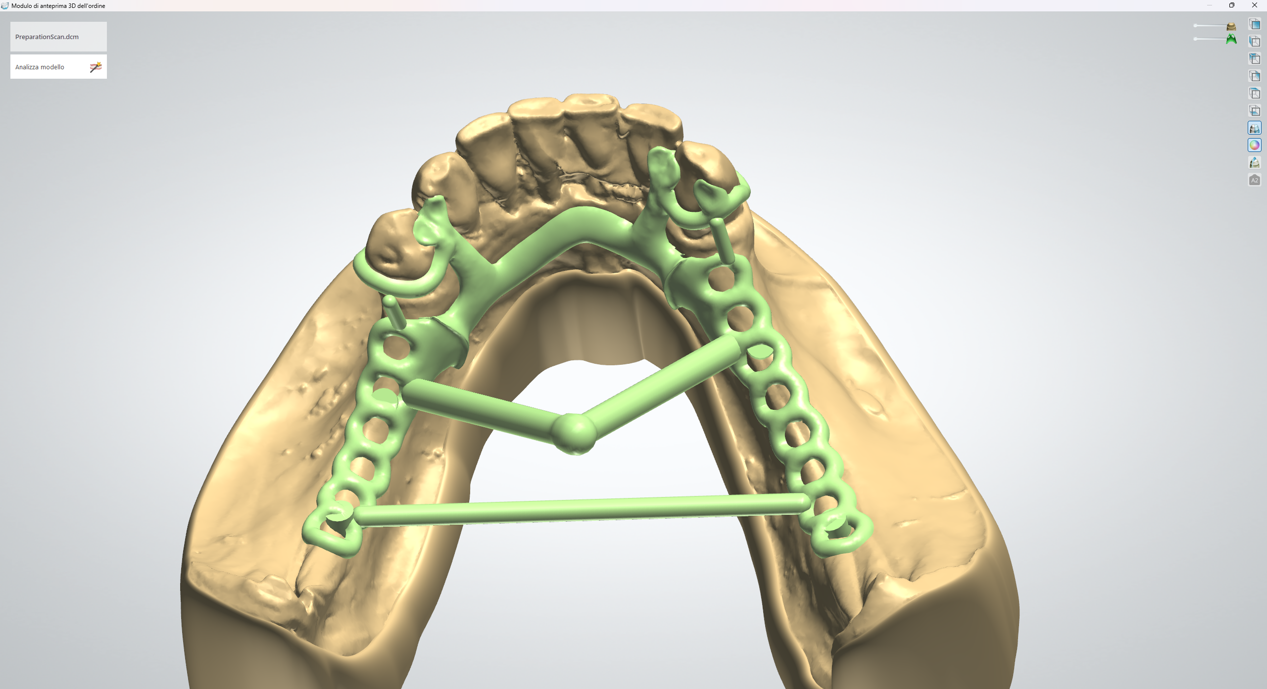 Cad-cast - New B Dental