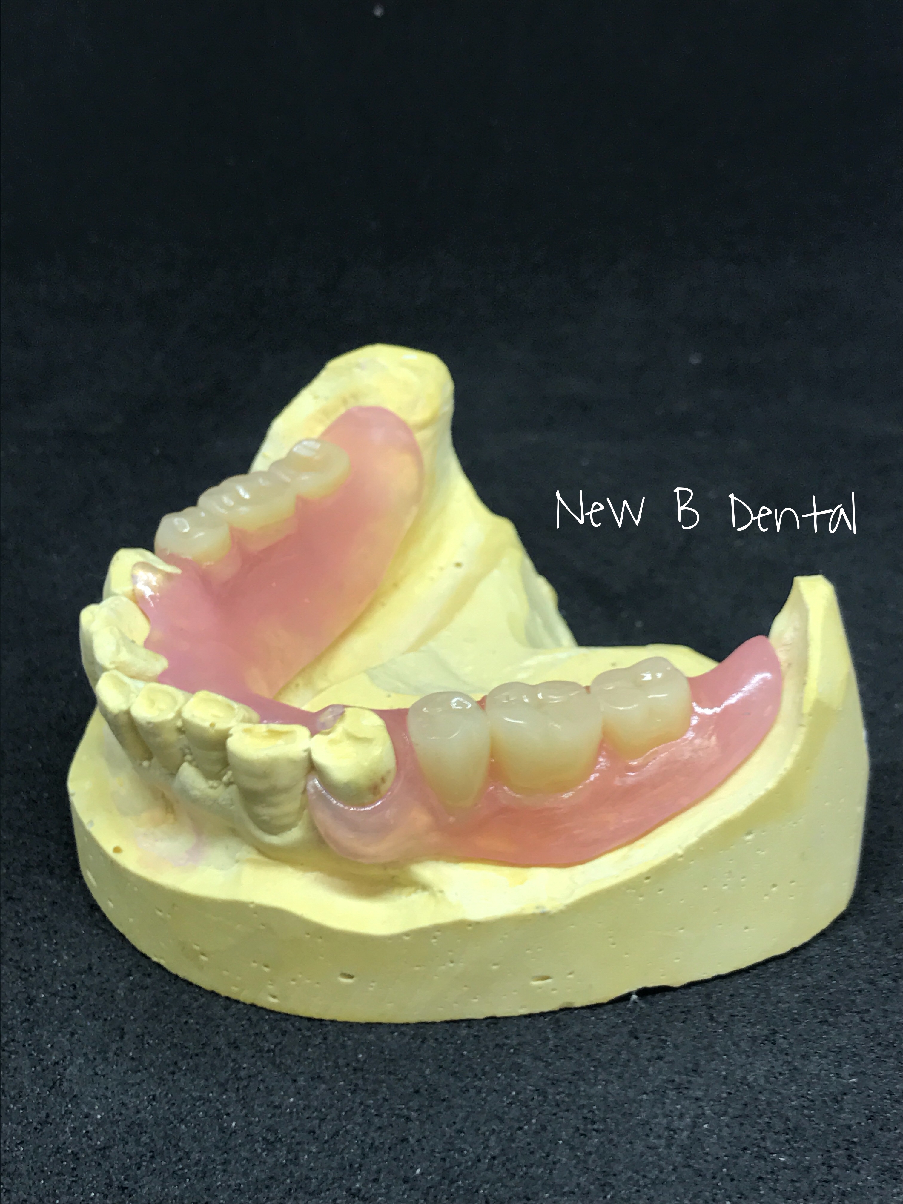 Nylon - New B Dental