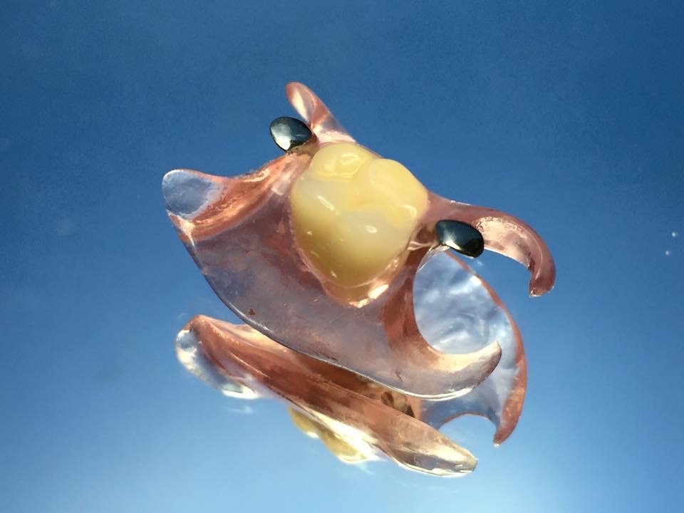 Nylon - New B Dental