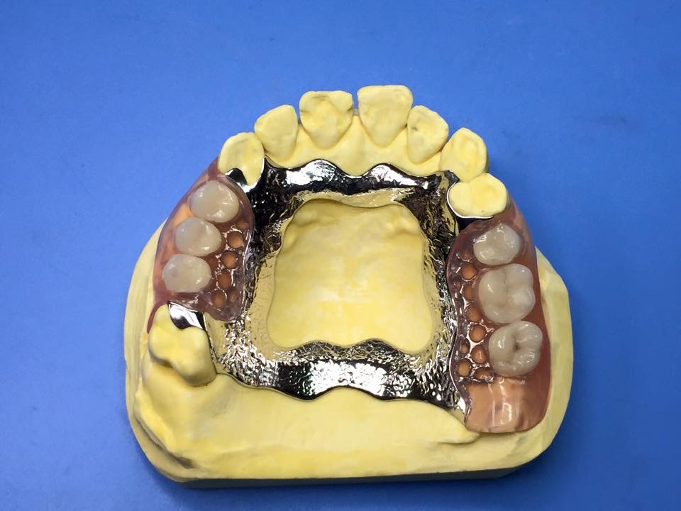 Scheletrati - New B Dental