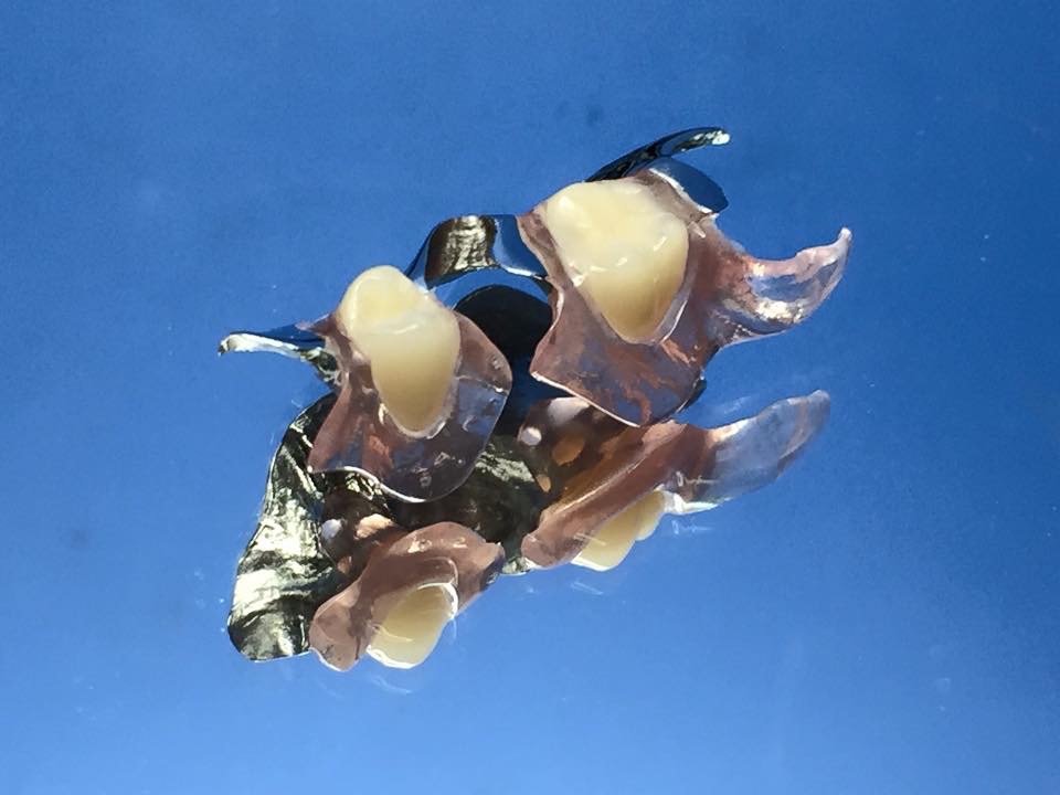 Scheletrati - New B Dental