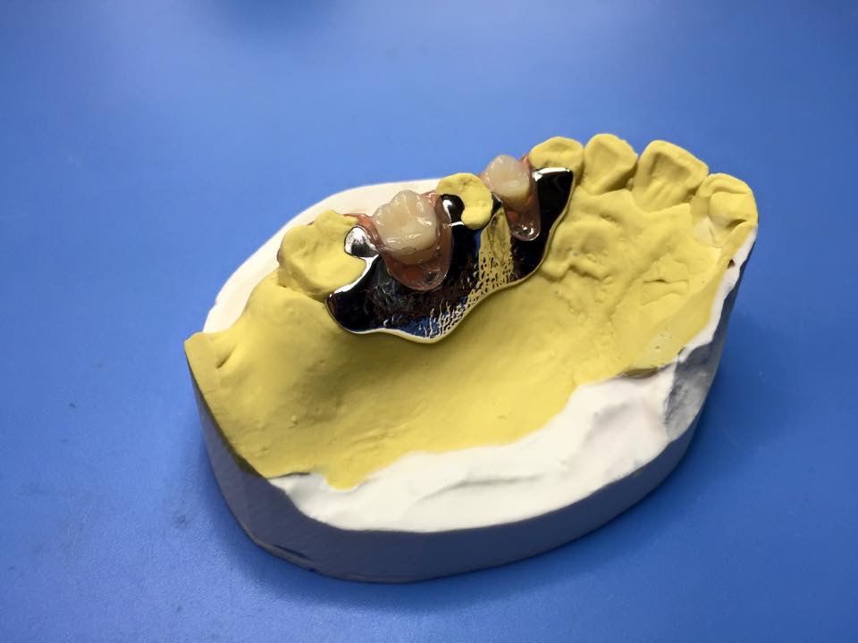 Scheletrati - New B Dental