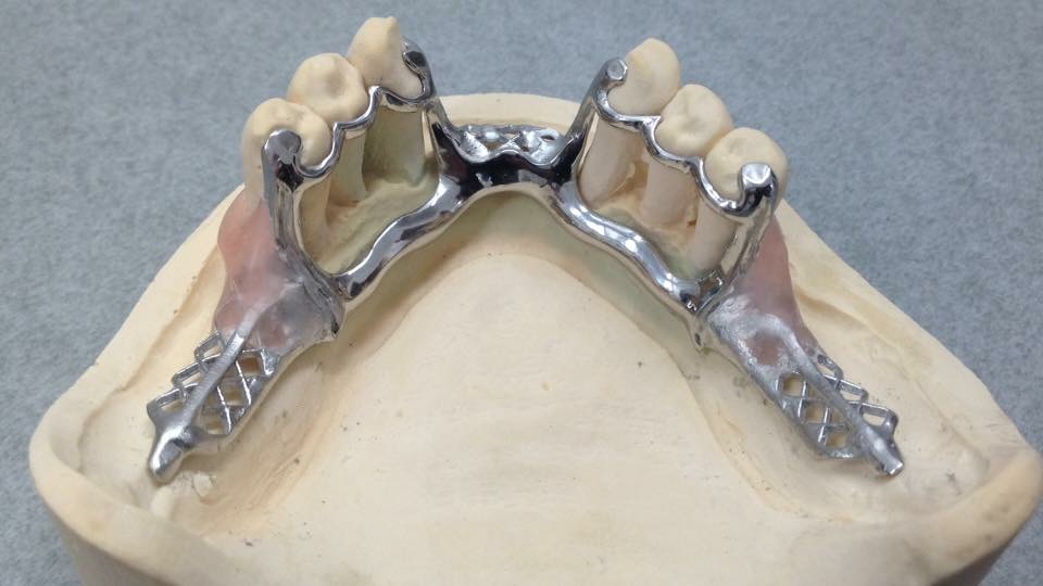 Scheletrati - New B Dental