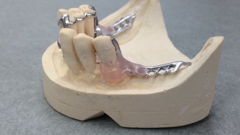 Scheletrati - New B Dental